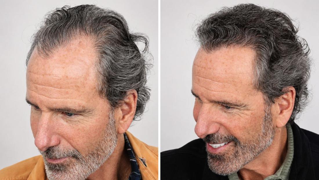 Todd M. before