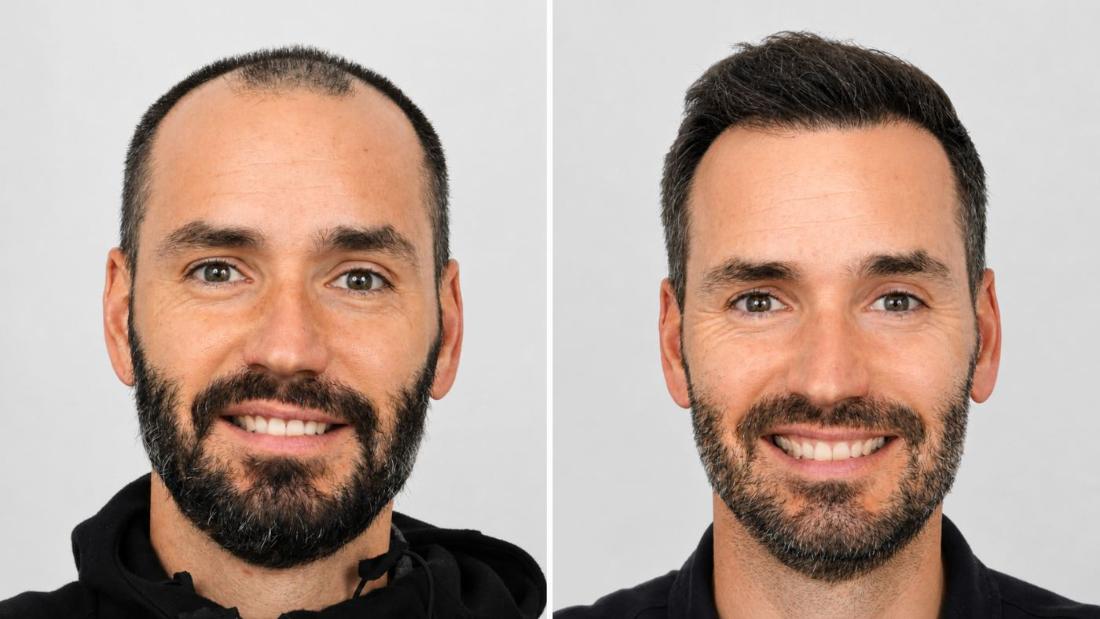 Craig W. before