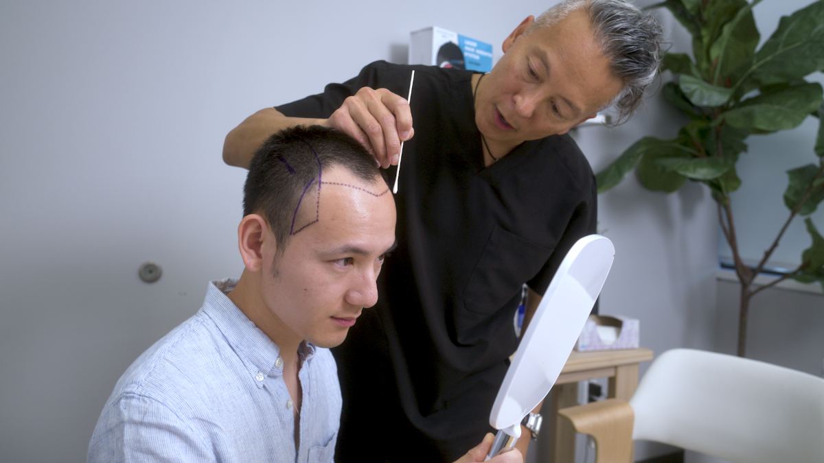 Hairline design session