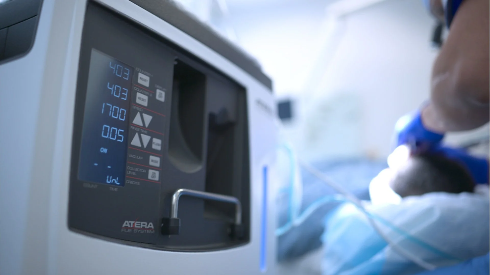 An automated FUE system console showing graft counters, with a hair transplant procedure in progress in the background