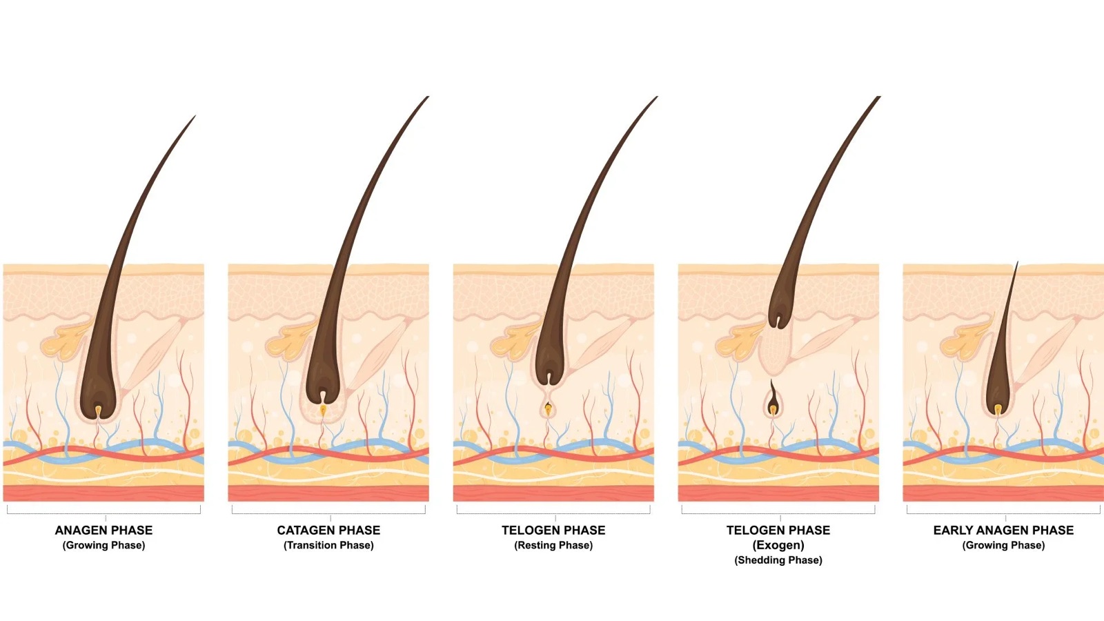 Hair growth stages diagram: anagen, catagen, telogen, exogen shedding and early anagen