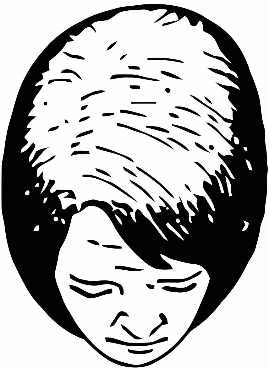Hair loss scale: Ludwig scale grade 2, an illustration of a woman's head seen from above with wider, more pronounced thinning across the top of the scalp and the front hairline intact